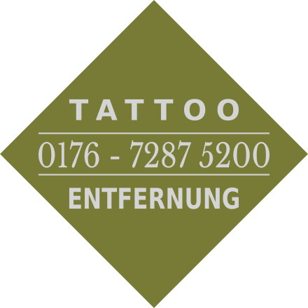 Farbecht Tattoo - Tattoo Entfernung